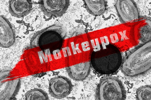Swab Test Antigen Harga: มีการวินิจฉัย monkeypox มากกว่า 1,000 รายในหลายประเทศ!